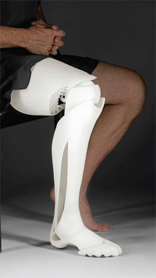 3D-Printed Prosthetic Limb
