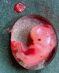 Six-Week-Old Human Embryo
