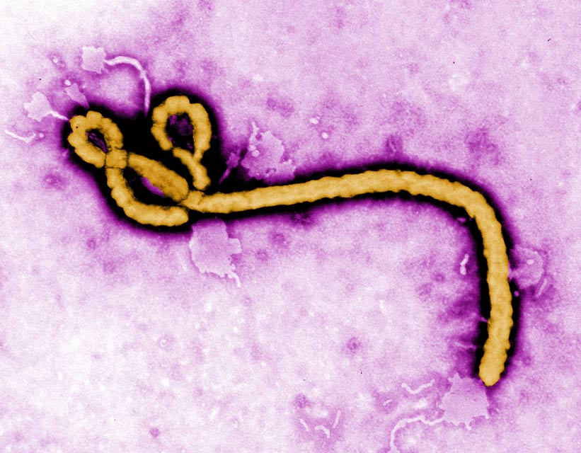 An Ebola Virion